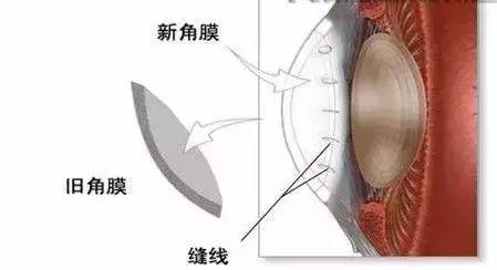 （网络配图）