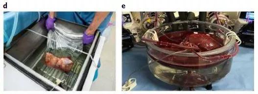  ▲肝脏在过冷池和常温血液再灌注（图片来源：参考资料[1]）