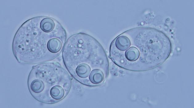 粘孢子虫的一个生命阶段生活在鱼类体内，另一个阶段则生活在水生蠕虫中。有研究者提出，这种寄生虫可能有一个奇怪的起源：以一种传染性肿瘤的形式演化成独立的物种