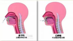 正畸专家教你预防纠正孩子口呼吸，家长必读！