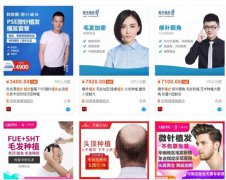 王思聪发际线后移、90后掉发，这个百亿市场“秃然爆发”