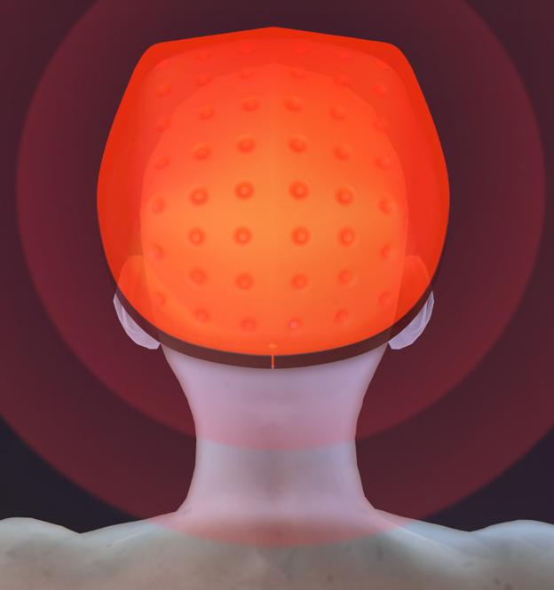 小米有品众筹激光生发帽，带上很帅气，12周长出新头发！