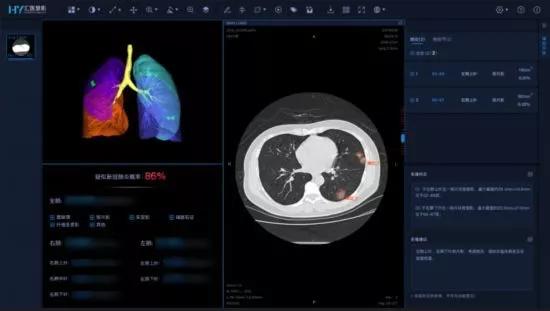 新冠检测系统用户数据被非法出售?国内首家AI医疗公司遭黑客入侵