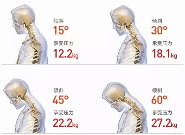 经常颈椎疼？肩颈痛？它解决了我多年不正确的坐姿
