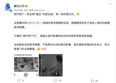 腾讯和深圳大学推出医学图像验证码