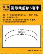 淘宝冷 “植”识：网上植发 95 后占半边天 这届年轻人不行啊！